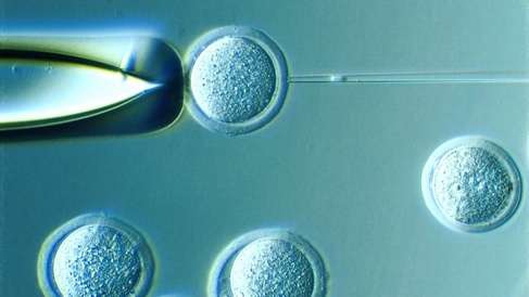 Nuclear transfer - nucleus in pipetteCloning by nuclear transfer. The nucleusfor transfer has been picked up into the transferpipette. It is about to be injected in to arecipient egg whose own nucleus has previouslybeen removed.